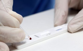 Covid-19: Brasil registra 1.271 novas mortes em 24h, total vai a 116.580